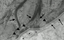 basement-membrane